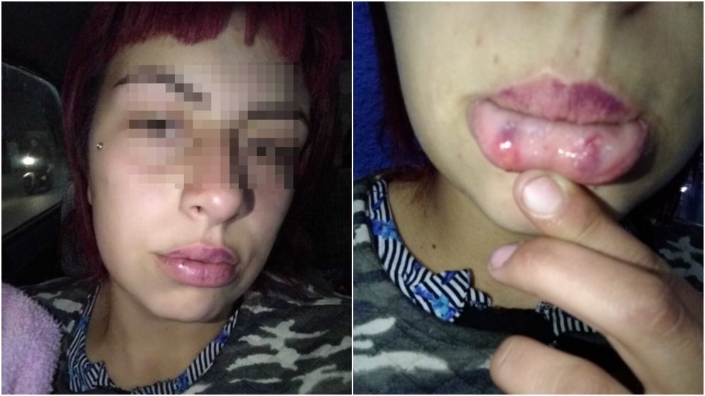 Una de las hijas de la denunciante tambi�n fue golpeada.
