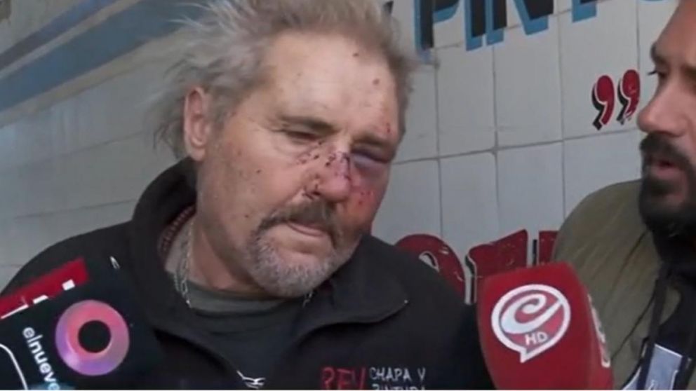 Mecánico arreglaba una camioneta, y el cliente le desfiguró la cara porque tardaba: "¿Cómo lo mataron a Fernando? A patadas y a piñas, yo zafé porque tengo 60 años".