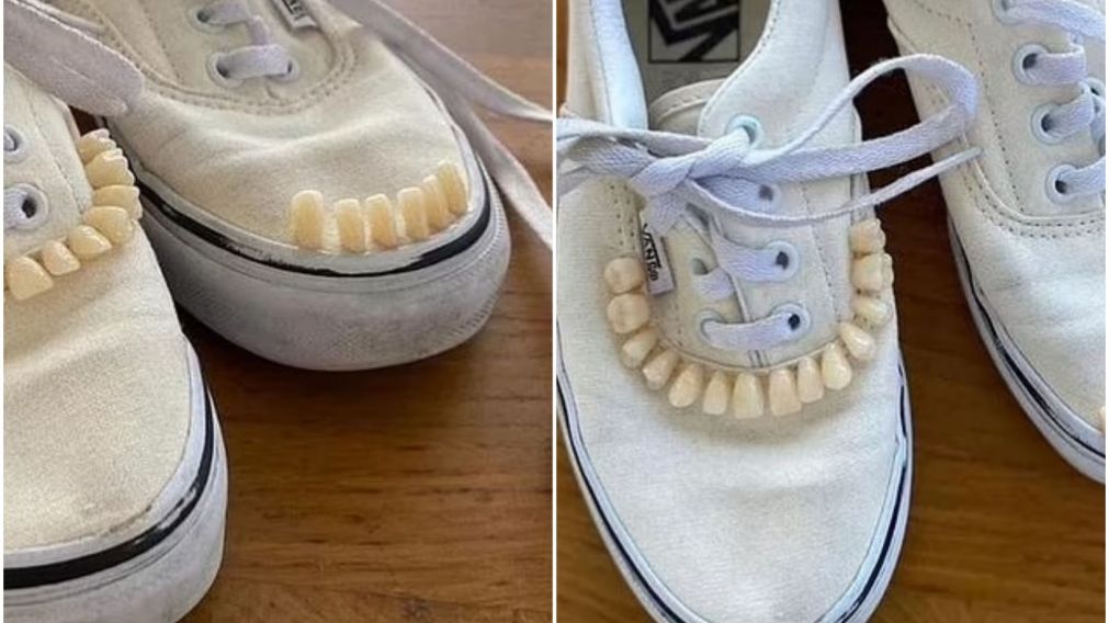 Pusieron a la venta zapatillas decoradas con dientes "humanos" y desataron una gran polémica en las redes (Imagen Daily Mail).
