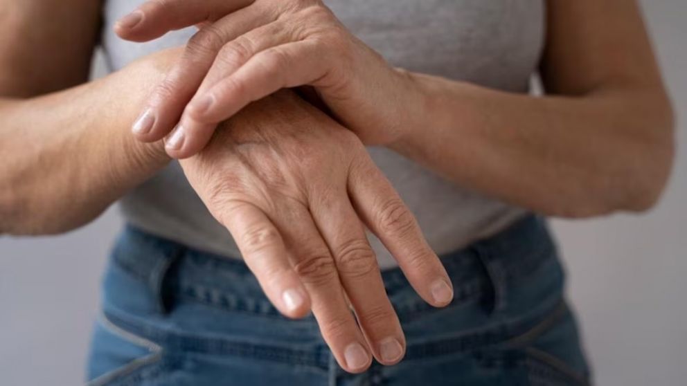 Fue al médico porque le salió una mancha en la uña y descubrió algo que le cambió la vida (Imagen ilustrativa).