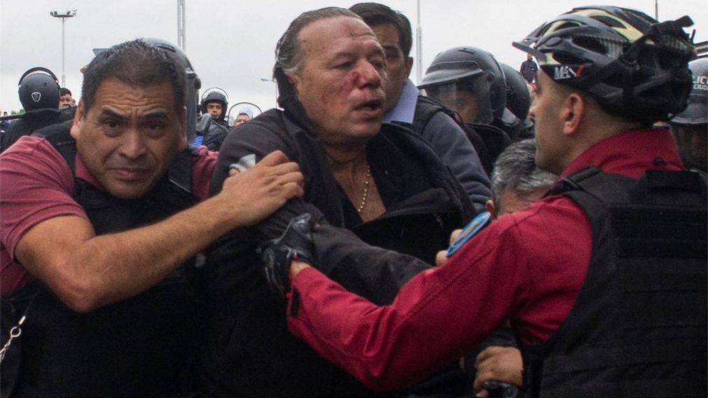 Por la paliza, Sergio Berni se tomará licencia médica.