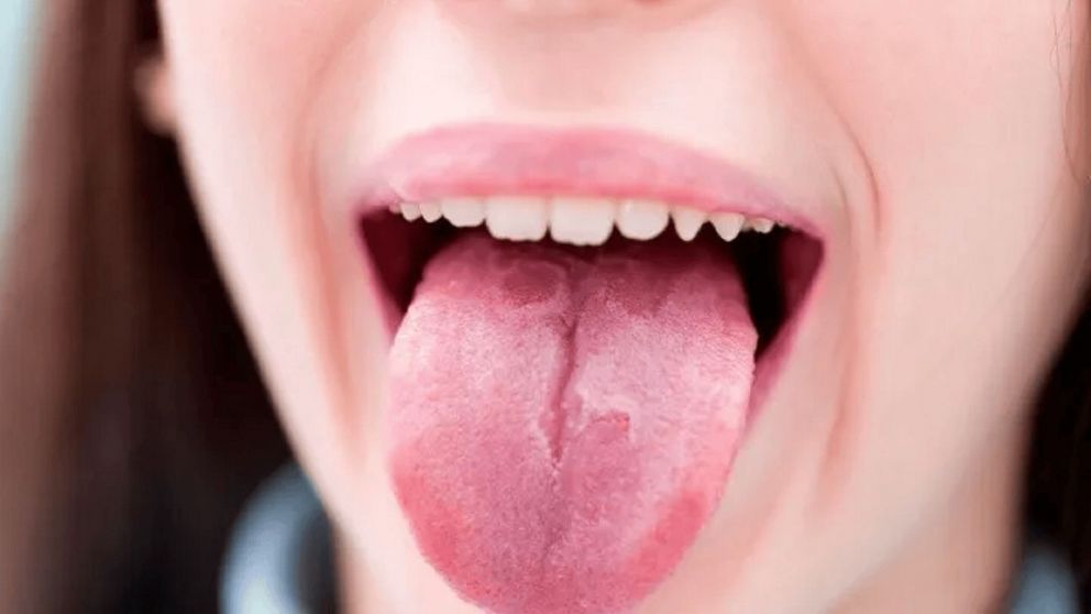 Le salían ampollas en la lengua y creía que era por estrés, pero el médico le dio un diagnóstico devastador