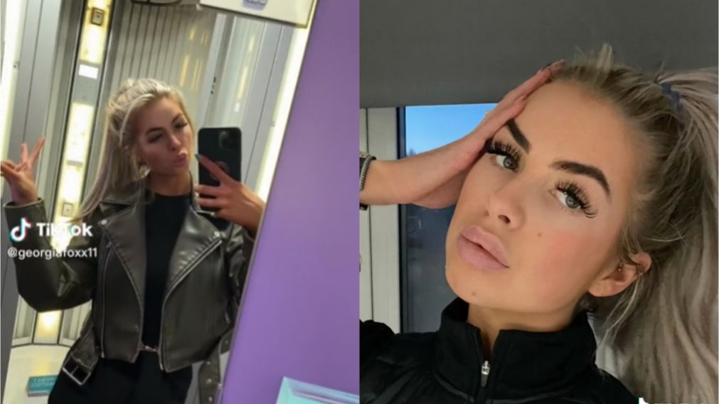 TikTok: se rellenó las mejillas, se deformó la cara y dejó una advertencia a sus seguidores