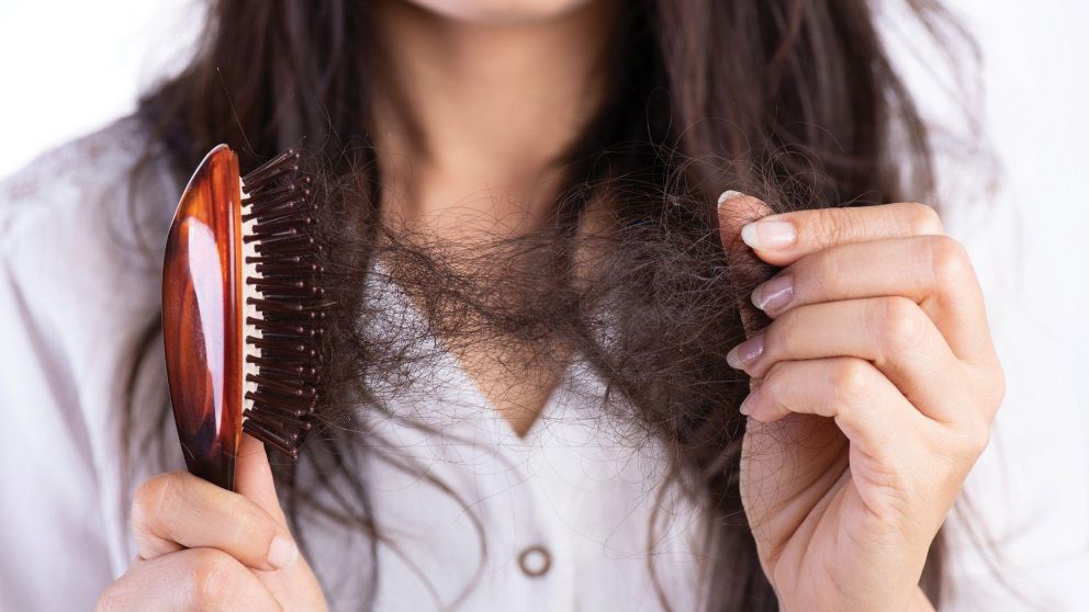 La ca�da de cabello es m�s com�n de lo que se cree (Imagen ilustrativa).