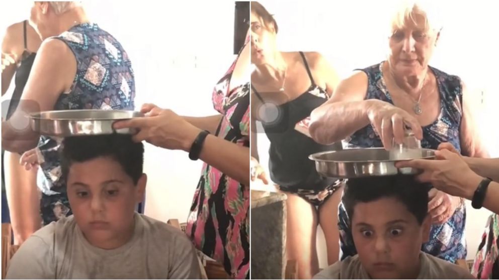 En TikTok se hizo viral un truco para curar la insolación, pero un médico confirmó que no funciona.