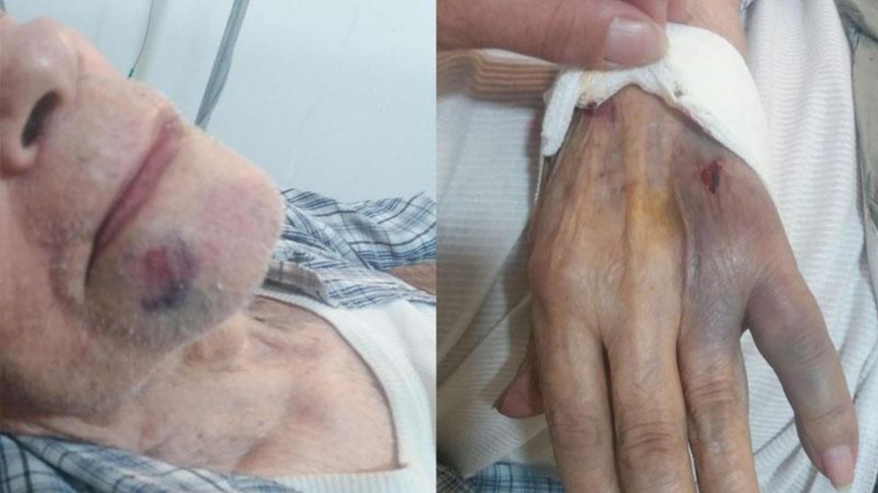 Tiene 91 años y lo molieron a golpes para robarle "los ahorros de toda su vida",