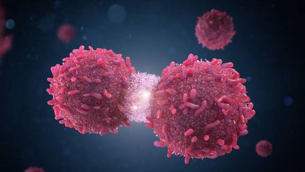 La inmunoterapia es un tipo de tratamiento para el cáncer que utiliza sustancias producidas por el cuerpo o en un laboratorio.