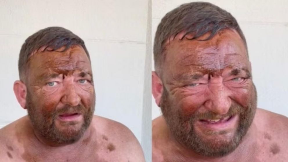 "Parecía caca": usó autobronceante, le mandó foto a su cita y lo dejaron plantado (TikTok).