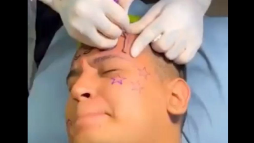 Mik Jams es el influencer colombiano que decidió llevar la palabra Messi en su frente por el resto de su vida.