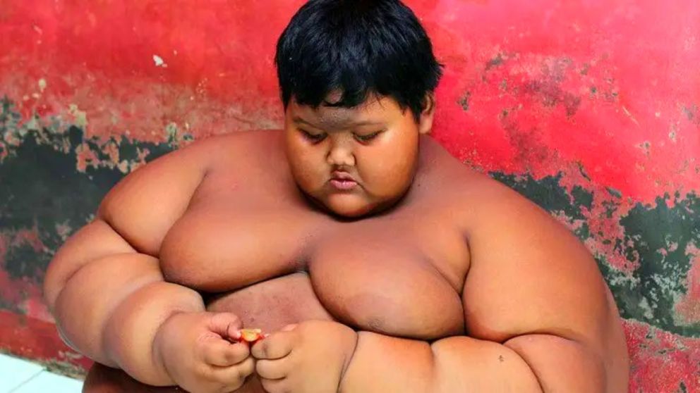 El ex "chico más gordo" adelgazó más de 100 kilos.