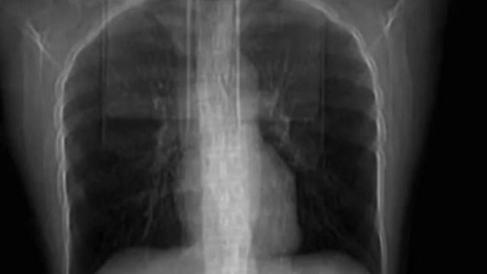 Esta es la placa que le tomaron a la mujer china (Twitter).