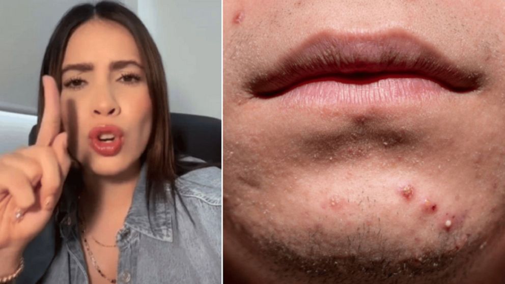 Una mujer descubri� una infidelidad por un detalle ins�lito.