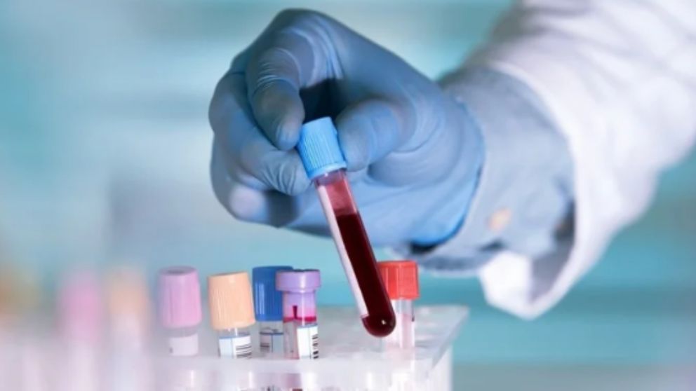 El ensayo resultaría un gran avance para la ciencia y el cuidado de la salud.
