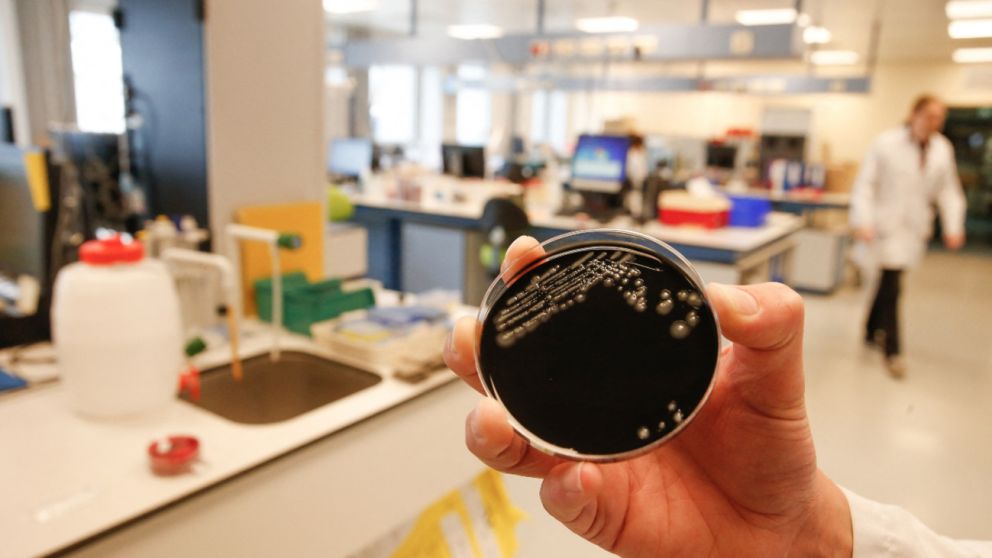 La bacteria legionella causó seis muertos en los últimos días en Tucumán (Imagen ilustrativa).