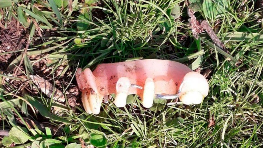 La pieza dentaria que se le cay� al ladr�n. (Gentileza Montevideo Portal)