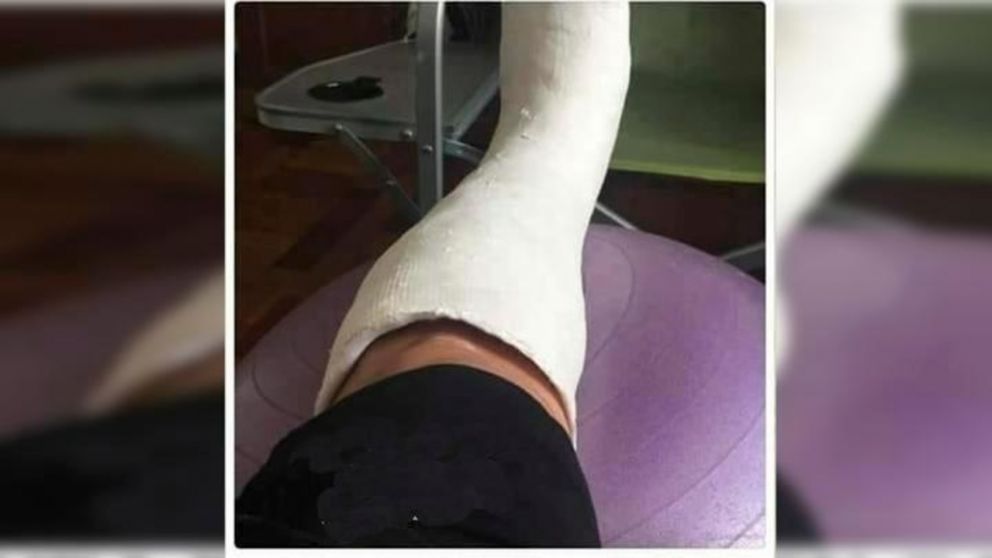 Ofrecen yesos truchos para faltar al trabajo y ver a la "Scaloneta" durante el Mundial (Imagen Twitter).