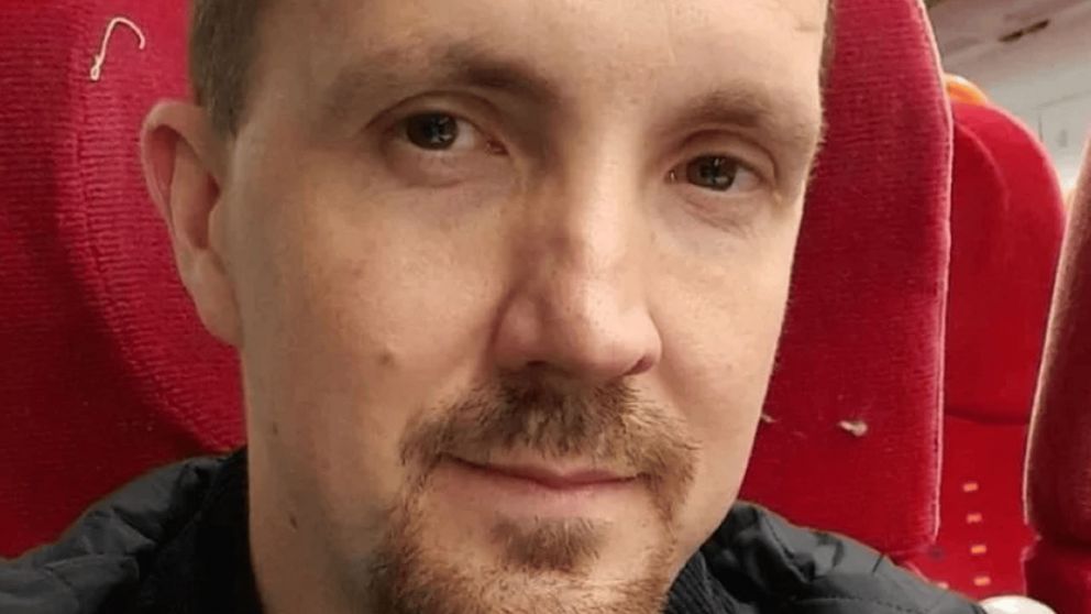 Un británico se volvió viral, tras vivenciar un milagro en su brazo.